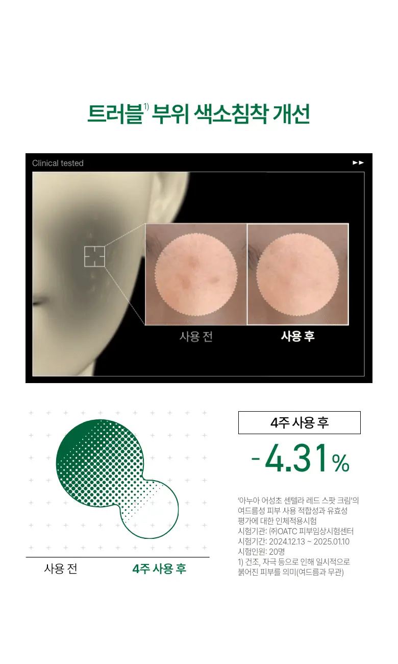 [단독기획] 아누아 어성초 센텔라 레드 스팟 크림 30g 2입 상세페이지 22